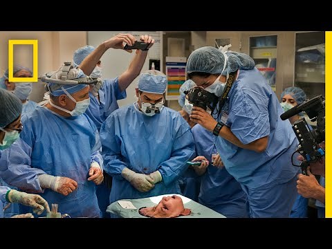 Youngest Face Transplant Recipient in U.S. | National Geographic