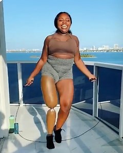 988K views · 16K reactions | Amputee model encourages women to embrace their bodies By Marsha Elle IG: instagram.com/marshaellemusic | Beauty Studio | Facebook