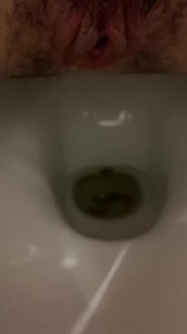 Loose poop - video 2