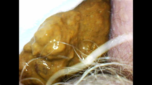 Diaper fill - video 2