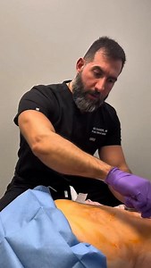 7.1K views · 40 reactions | muscle knots / trigger points pain relief #muscleknot #triggerpoint #painrelief #painmanagement #musclepain | Dr Painkiller | Facebook