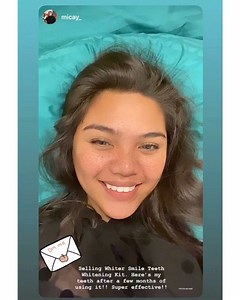 With Whiter Smile, you’ll always want to smile with pearly white teeth 🤩 Like our client turned reseller from Gensan! You may also contact her for orders btw! Thank you Ms @micay_ 🤗 | Skin and Body Wonders