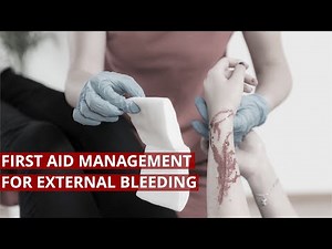 First Aid Management for External Bleeding #FirstAid #Lifesaver