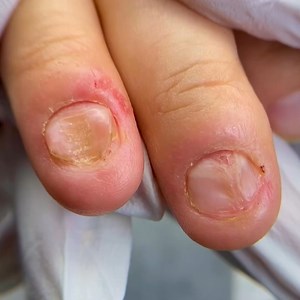 10K views · 176 reactions | Transformation of the bitten nails | Alena Lavrenteva | Facebook