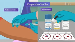 Acute Normovolemic Hemodilution in Adult Cardiac Surgery - Watch Related Videos