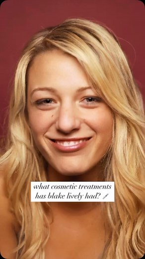Blake Lively’s Glow Up—Effortless, Elegant, Evolved Blake Lively has always been a beauty, but her transformation over the years has been subtle perfection. From her soft, refined features to her radiant skin and timeless style—her glow up is the definition of grace meets glam. Rumored rhinoplasty? Maybe. Expert tweakments? Possibly. Either way, it’s done right—enhancing her natural beauty without ever overdoing it. At Nude Aesthetics, that’s our vibe too: subtle, intentional, and always tailore
