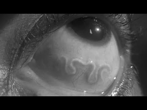 Top Fatal Diseases Ever