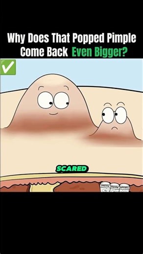 why does that Popped Pimple Come back EVEN BIGGER? #3danimation #animation #animationvideo #anime