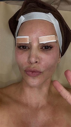 Kim Kardashian Fans FLIP Over Her Bizarre Korean Beauty Procedures #kimkardashian #kardashians | Beyond The Screen