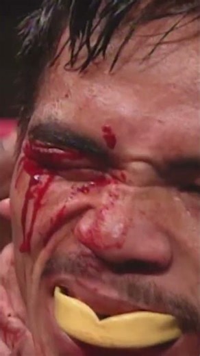 Manny Pacquiao vs. Agapito Sanchez - Fight Highlights