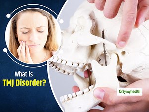 What Is TMJ Syndrome? Here Are Its Symptoms, Causes, Treatment And Side-Effects