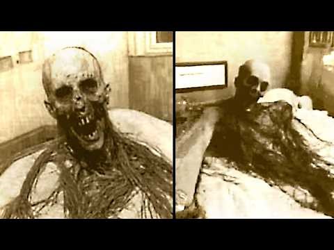 Unbelievable Human Mutations That Still Can’t Be Explained