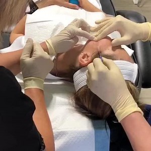 Mint PDO Face Thread Lift