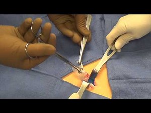 Postpartum BTL SimFinal