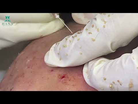 Satisfying Relaxation With Hana Spa #24