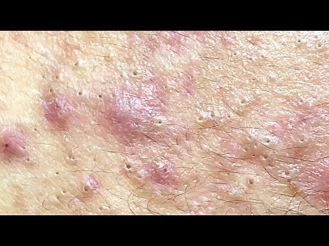 Relax Every Day With Sac Dep Spa #0070