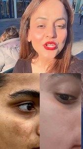 1K views · 18 reactions | Skin care kit ☎️ 9034206224 Nisha Lambha - Sparsh Beauty Care & Hair Treatment LLP #trendingreels #reelsfb #hairgoals #hairstyle #Khaliyat | Nisha Lambha - Sparsh Beauty Care & Hair Treatment LLP 5 | Facebook