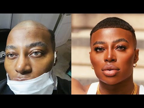 I GOT A MAN WEAVE / UNIT! BEFORE & AFTER! HUGE TRANSFORMATION! | ThePlasticBoy