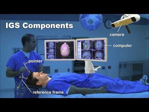 Image Guided Surgery for Brain Tumors