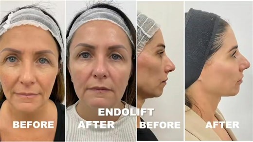 The One Clinic. Medical & Aesthectic Clinic in Leicester. - Supporter of the Sabras 30th Anniversary Celebrations. Sunday 7th September 2025 ✨ #sabrasradio30 The One Clinic | Sabras Radio | Facebook