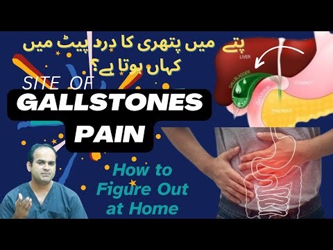 Gallbladder Stone Pain: Learn the Different Locations & Self-Assessment