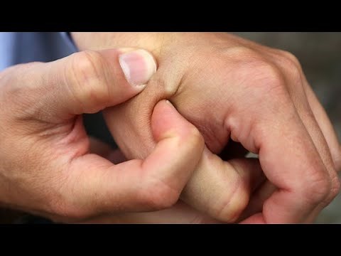 Would you get 'microchipped' at work?