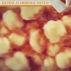 ✨ Magnetic Slimming Patch – Melt stubborn fat effortlessly! 🔥 Boosts metabolism, reduces bloating & supports faster slimming. 🌿 Easy to use, natural & effective — slim smart, feel light! 💛💧 | Heal Genz