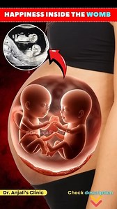 1.9M views · 25K reactions | Twins in the Womb- Watch Them Wiggle & Grow! #twins #womb #baby | New Born Baby | Facebook