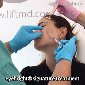  Nonsurgical Procedure: Eyebright® signature treatment  Available Exclusively at @liftmd ✅Certified #drkassabian Method  @liftmd Medical Spa In-Office Procedure ⏰ Long Lasting Immediate Results with Minimal to No Bruising or Downtime. ☎️ (310) 285-0400 | Dr. Garo Kassabian | Facebook