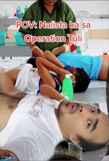 Operation Tuli tuwing summer. #foryoupage #trending #viraltiktok #tiktok #fyp