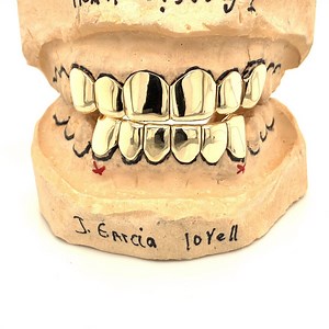 Gold Perm Cut Grillz custom made by Seattle Gold Grillz