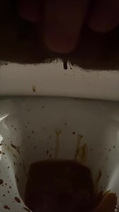 Pooping diarrhea on toilet 22nd & 24th May 24