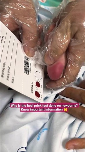 Why is the heel prick test done on newborns? Know important information 👶#shorts #baby #justborn