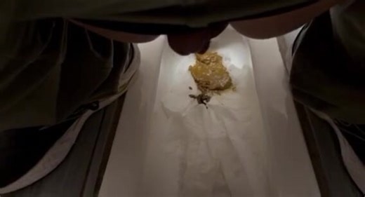 stomach upset and diarrhea