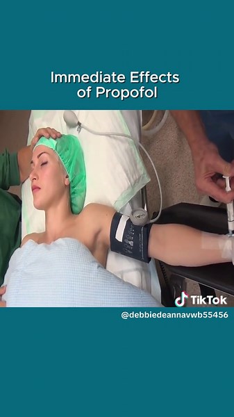 Immediate effects of propofol #foryou #Dr_B #anesthesia #propofol #surgery