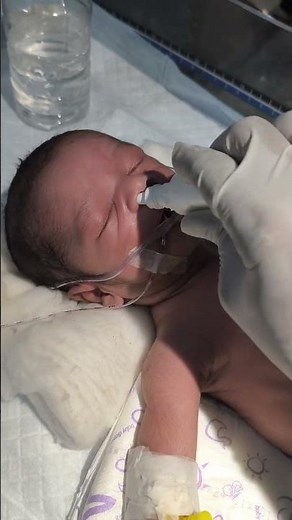 Chestryped for newborn baby😌 #sumitnicunursingstm #youtubeshorts #nursing #newbornbaby #chestworkout