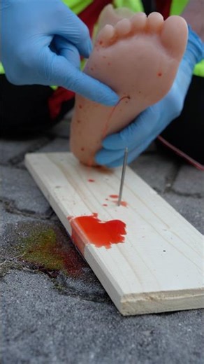First Aid if you stepped on a Nail! 🚑🩸 #paramedic #ambulance #emergency #firstaid #hospital #nurse