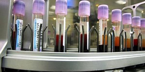 The Cancer Biopsy of the Future Could Be a Simple Blood Test