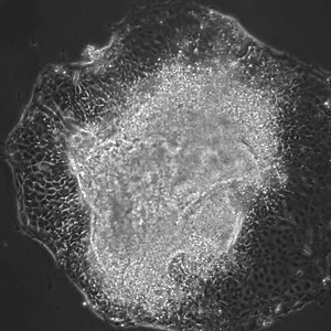 File:Novel-Mode-of-Defective-Neural-Tube-Closure-in-the-Non-Obese-Diabetic-(NOD)-Mouse-Strain-srep16917-s1.ogv - Wikimedia Commons