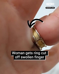 This is the satisfying moment a woman has her wedding ring cut off her swollen finger | Metro
