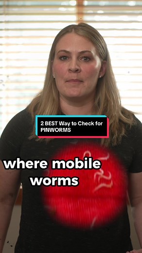 How to Check for Pinworms: Effective Home Tests Explained