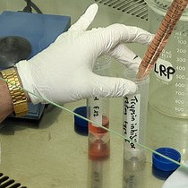 Isolation of Neural Stem Cells from Mouse | JoVE Journal