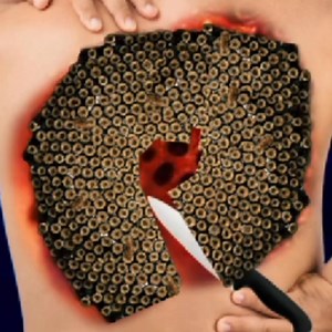 9K views · 36 reactions | ASMR severely affected centipede trypophobia back side | ASMR 2d deep cleaning animation treatment | #asmranimation #asmrvideo #animationvideo #animation #viralvideo #asmr | ASMR Makeup | Facebook