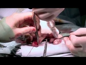 Mangled Hand - Bizarre ER