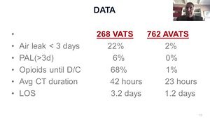 AVATS ( Awake Video Assisted Thoracic Surgery) vs. Standard VATS: Comparison of Air Leak Rates/Duration
