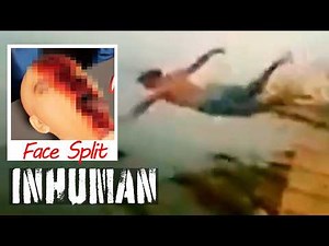 Teen Splits Face in Half Jumping Off Cliff - FACE SPLIT