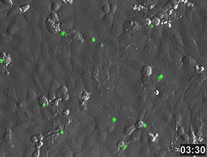 File:The-Carbon-Monoxide-Releasing-Molecule-CORM-2-Attenuates-Pseudomonas-aeruginosa-Biofilm-Formation-pone.0035499.s003.ogv - Wikimedia Commons