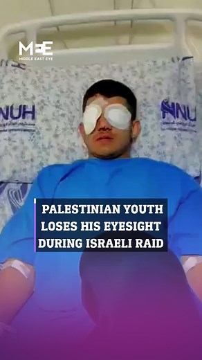 “Suddenly a grenade exploded in front of me. It blinded me and destroyed my life.” Palestinian youth Omar Asse was blinded when a grenade exploded in front of him during an Israeli raid in his town of Qarawat Bani Hassan in the occupied West Bank last night, while he was buying groceries for his family | Middle East Eye