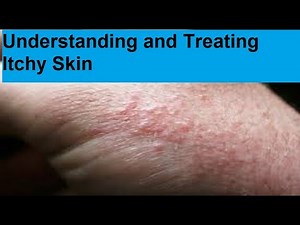 Understanding and Managing Itchy Skin