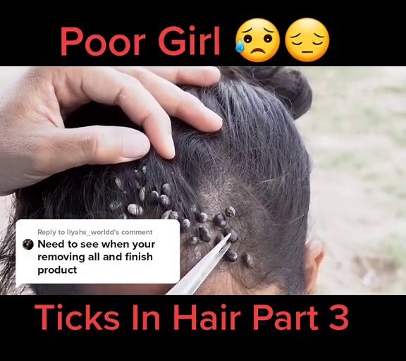 Understanding Trypophobia: Phobia of Holes in Skin